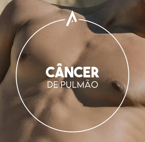 Câncer de Pulmão - Dr André Luiz Carneiro